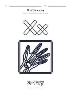 Letter X coloring page: X is for x-ray printable worksheet for preschool and kindergarten